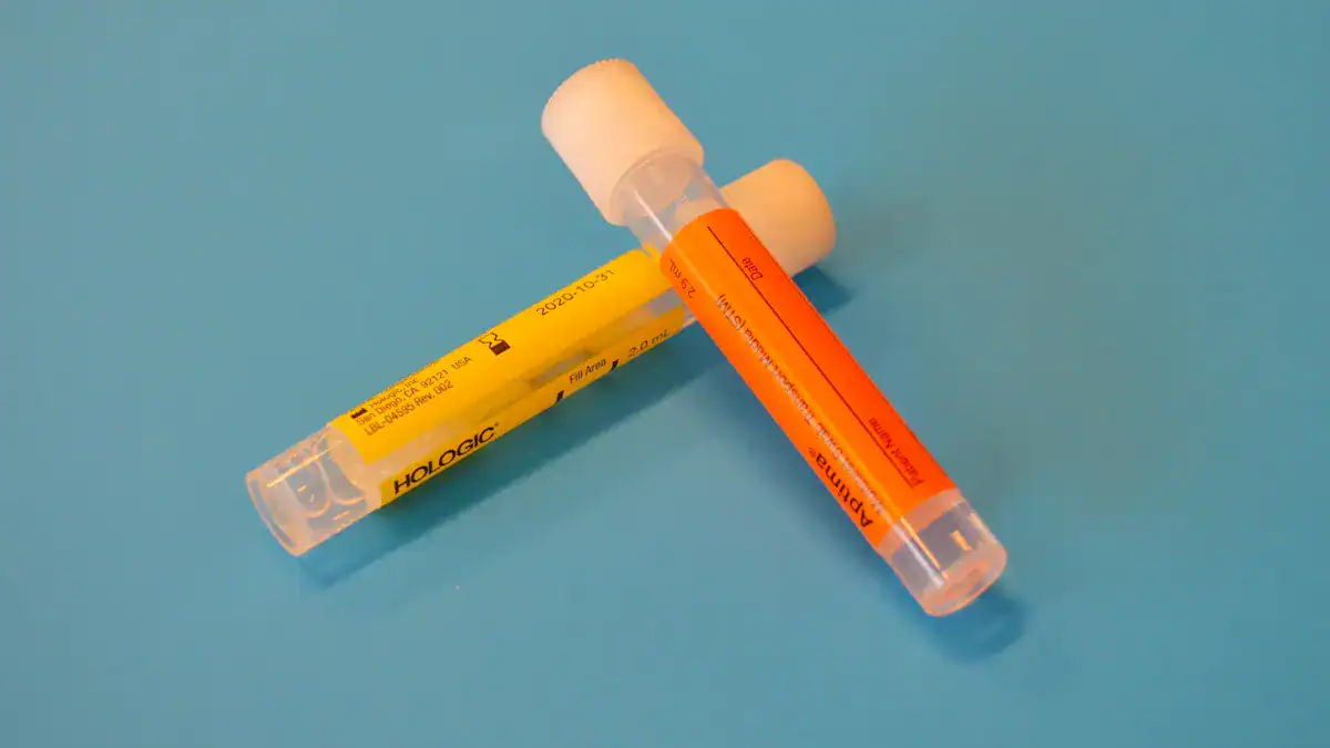 Understanding Urinalysis
