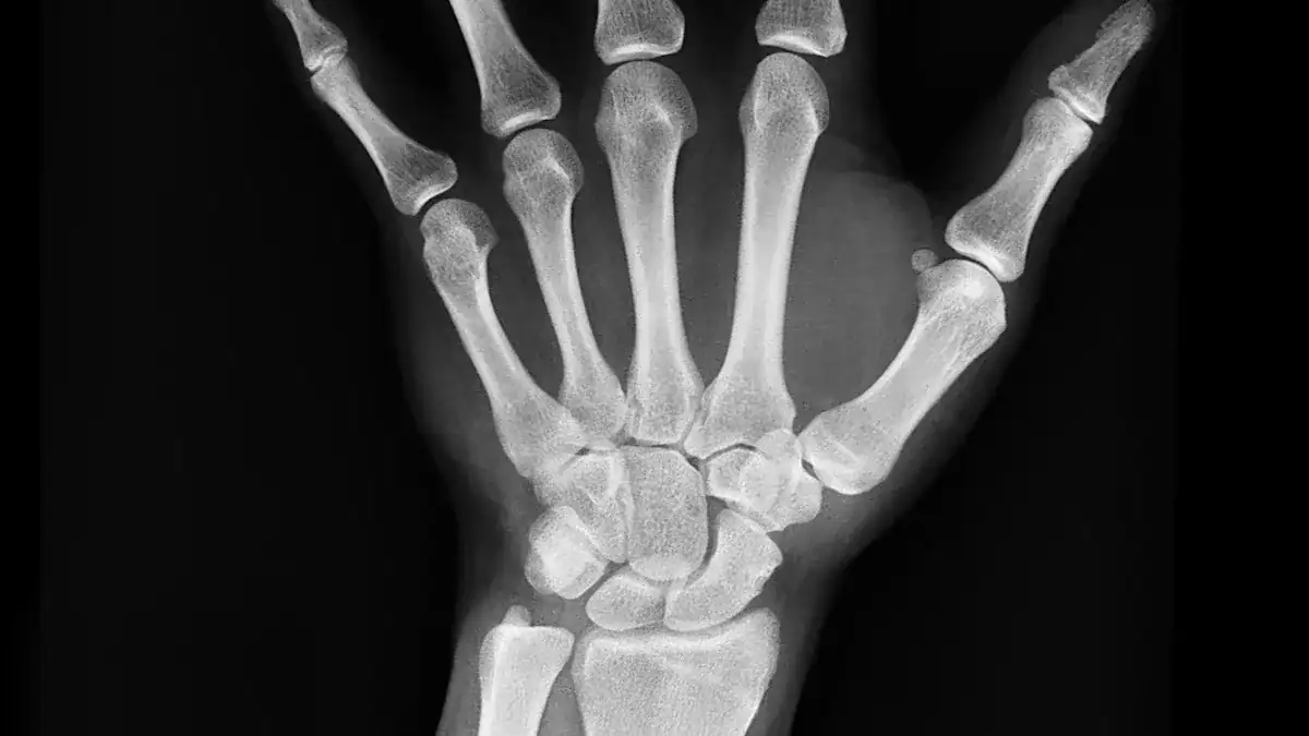 How is Wrist Pain Diagnosed?