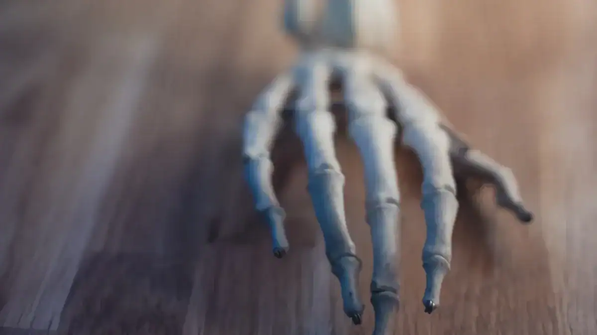 Metacarpal Bones: The Palm'
style=