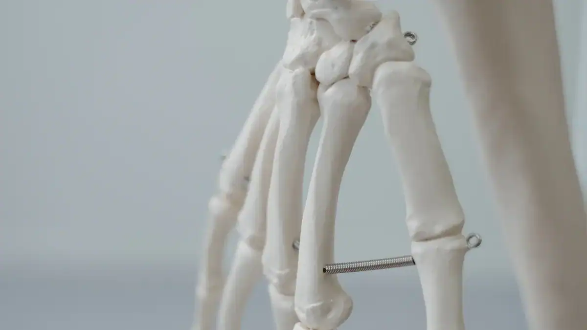 Carpal Bones: The Wrist'
style=