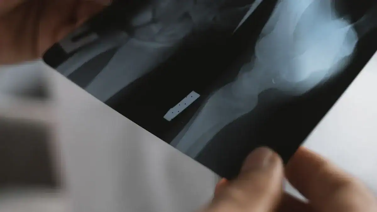 Diagnosis Process For A Hard Foot Lump