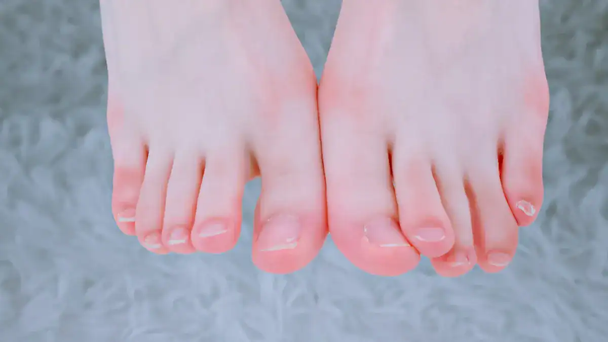 Common Lumps On The Side Of The Foot (Non-Urgent Context)