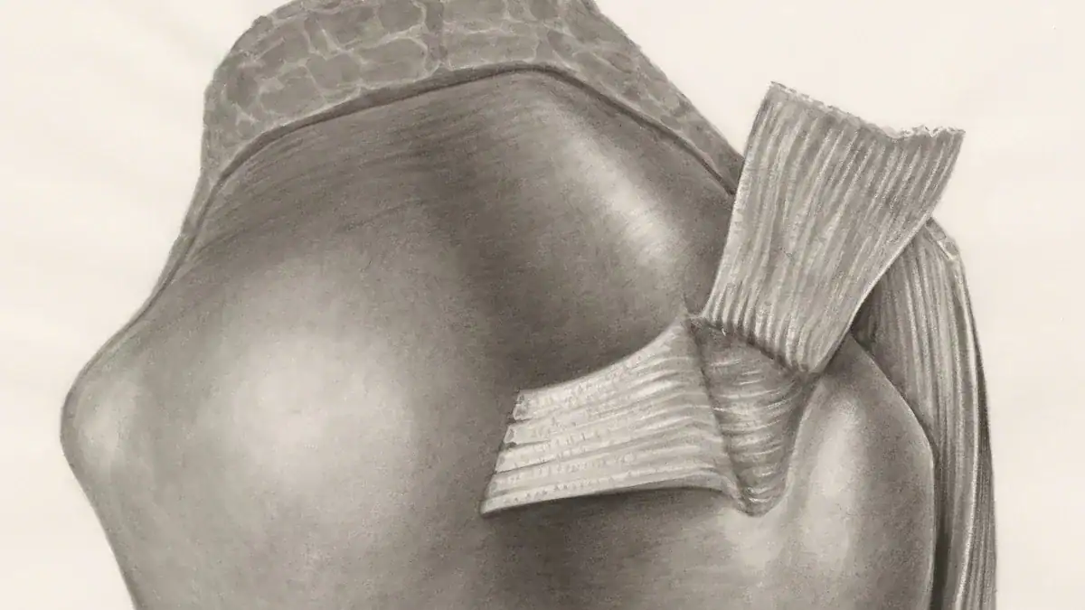 Common Causes of Shoulder Pain: Rotator Cuff Issues