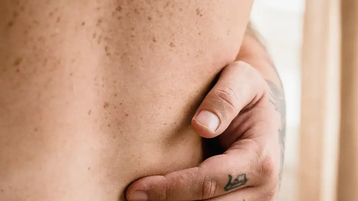 Can You Still Get Shingles If Vaccinated? Truth Revealed