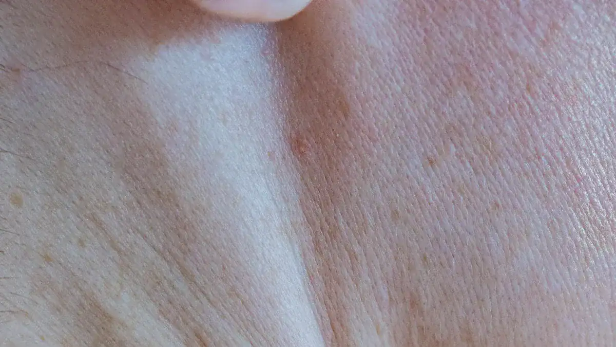 Understanding Lymph Nodes