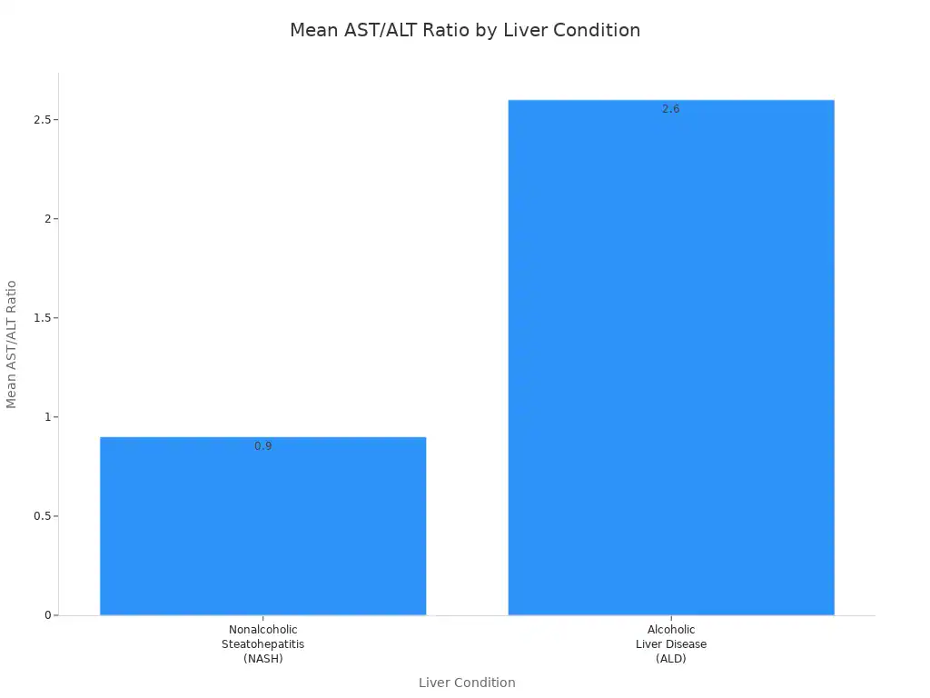 A bar chart comparing the mean AST/ALT ratio for Nonalcoholic Steatohepatitis (NASH) and Alcoholic Liver Disease (ALD). NASH has a ratio of 0.9, while ALD has a ratio of 2.6.