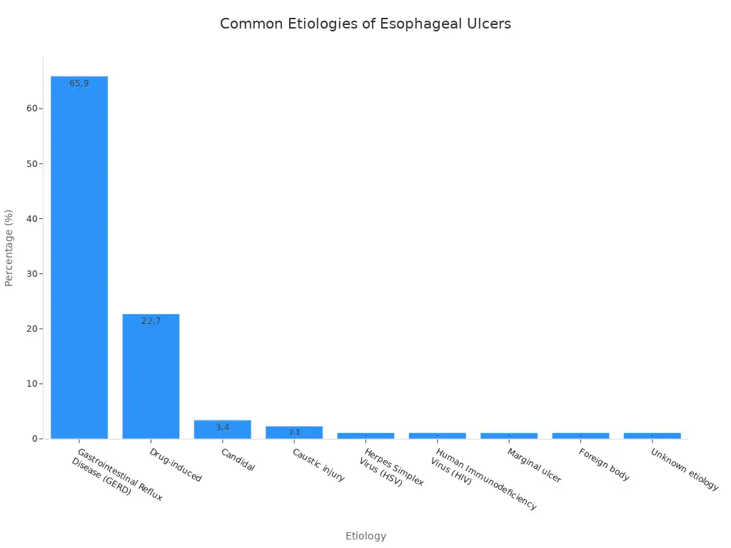 A bar chart showing the percentage distribution of common etiologies of esophageal ulcers. GERD is the highest at 65.9%.