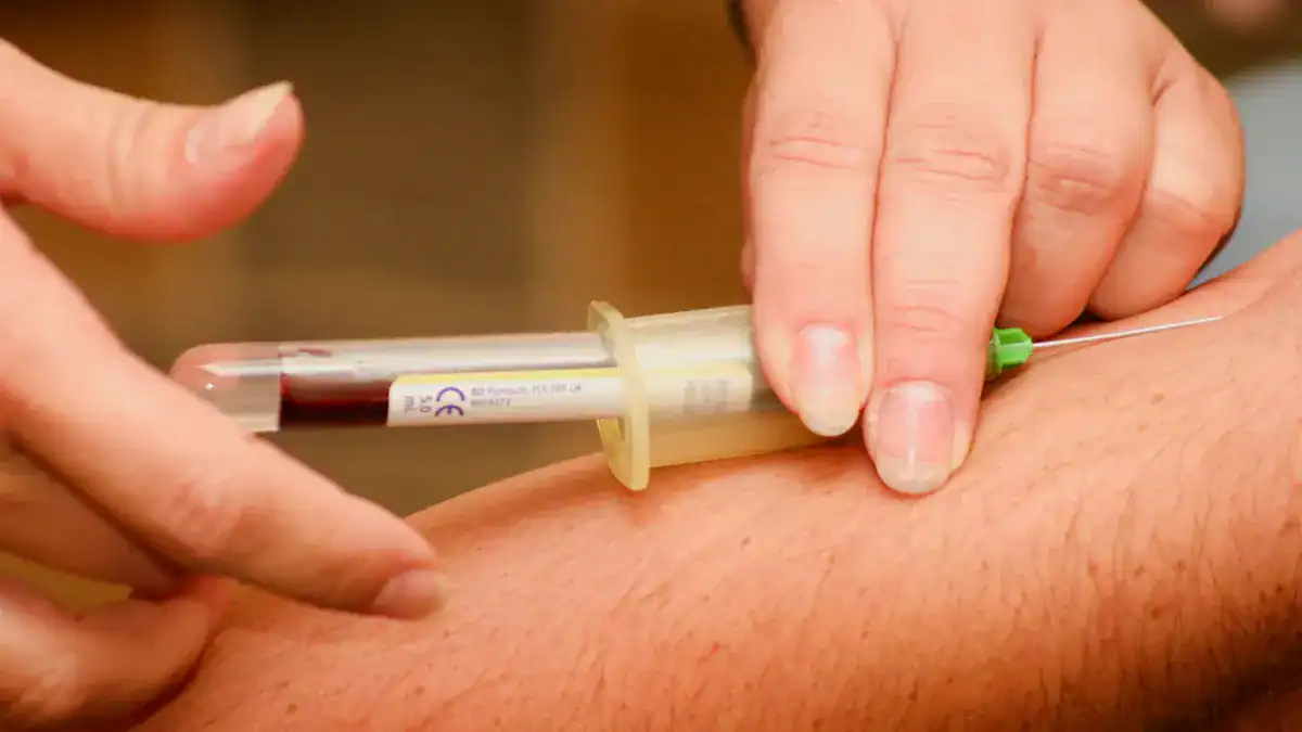 Testing Your Triglyceride Levels