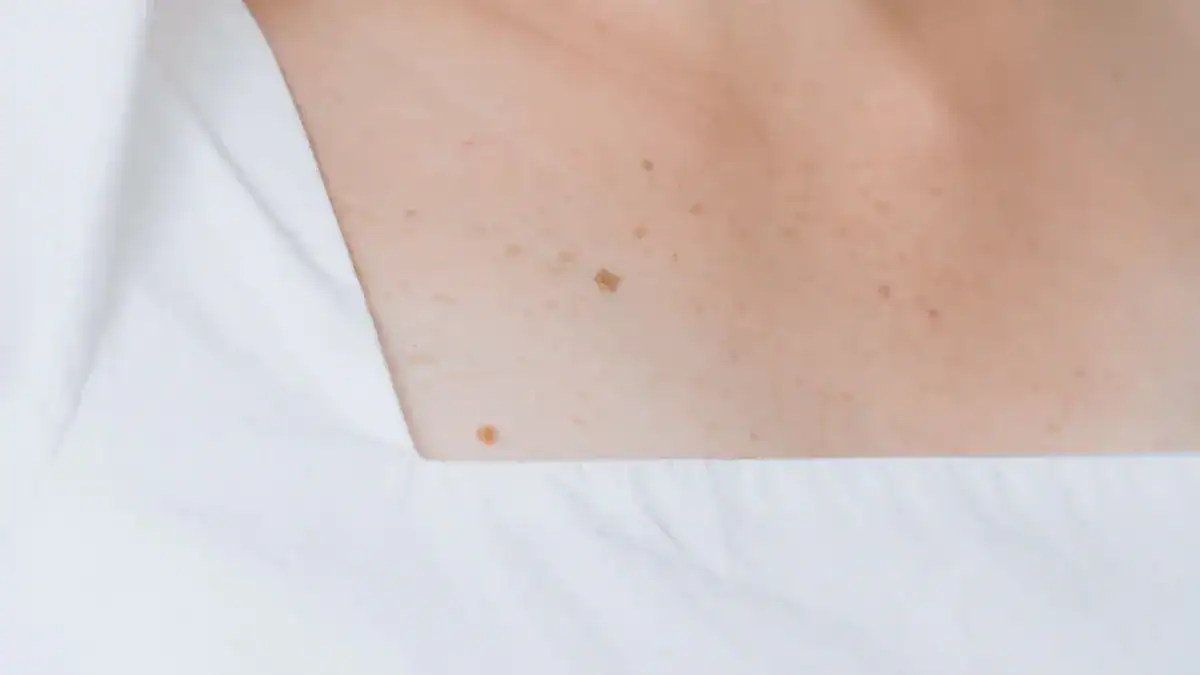 Painful Lymph Nodes Along Neck: Urgent Causes & Concerns