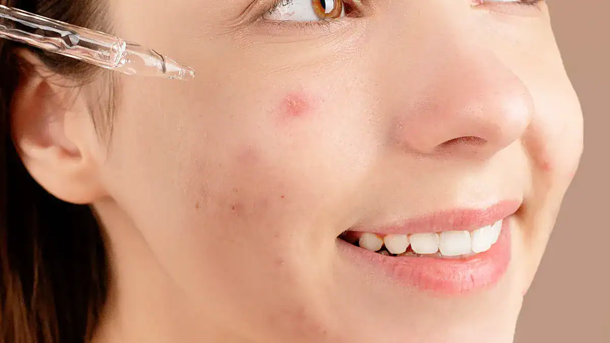 Why Homemade Facial Masks: