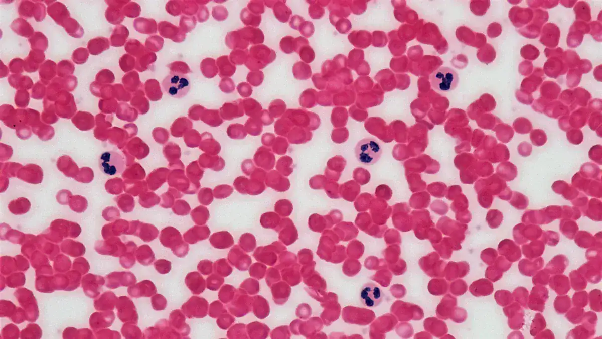 Understanding Low RBC Count and Anemia