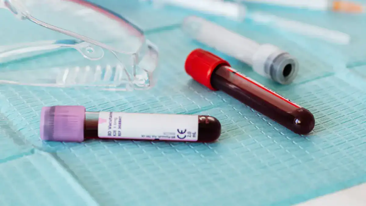 Managing High MPV: When to Act