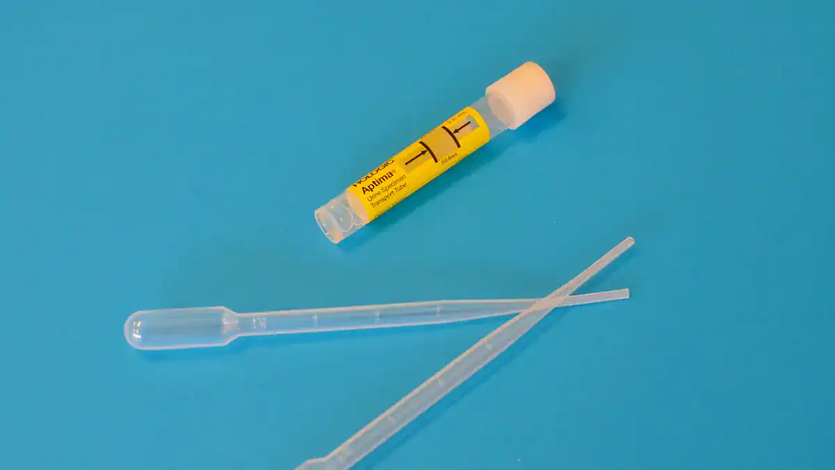 What Is Normal Range For Creatinine In Urine?