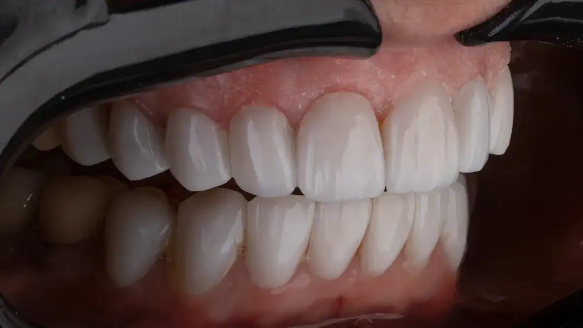 Adult Tooth Chart Explained