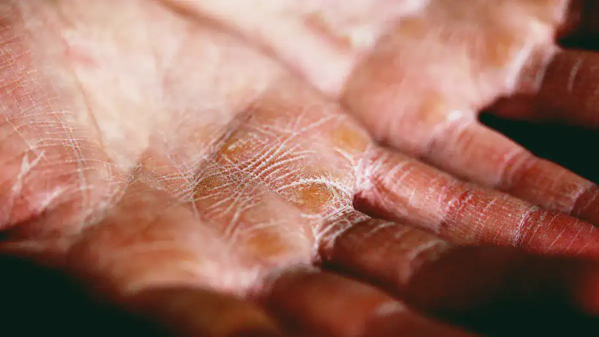 Numbness In Fingers: Causes, Diagnosis, & Treatment