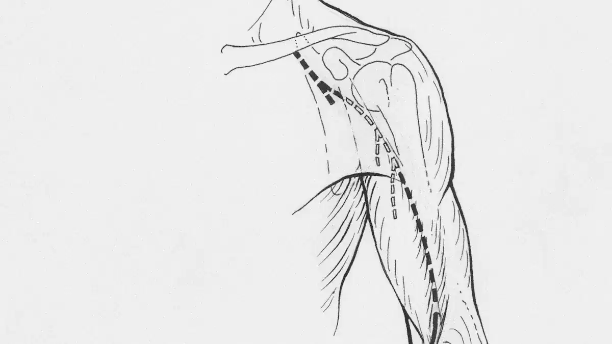 Nerve Compression & Neurological Arm Pain