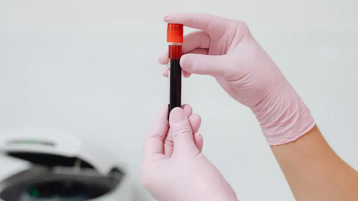 Next Steps for Blood in Catheter