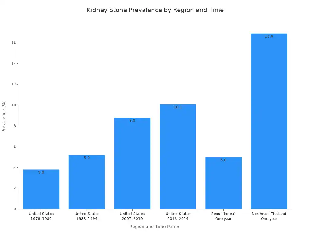 A bar chart showing the prevalence of kidney stones in different regions and time periods, with values ranging from 3.8% to 16.9%.