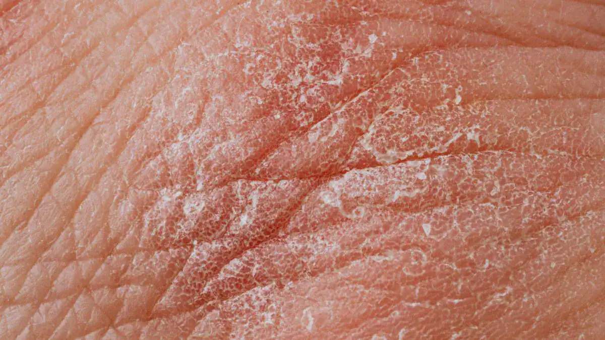 10 Urgent Warning Signs Of Dehydration