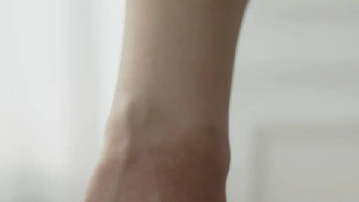 Understanding Foot Swelling After Hip Replacement