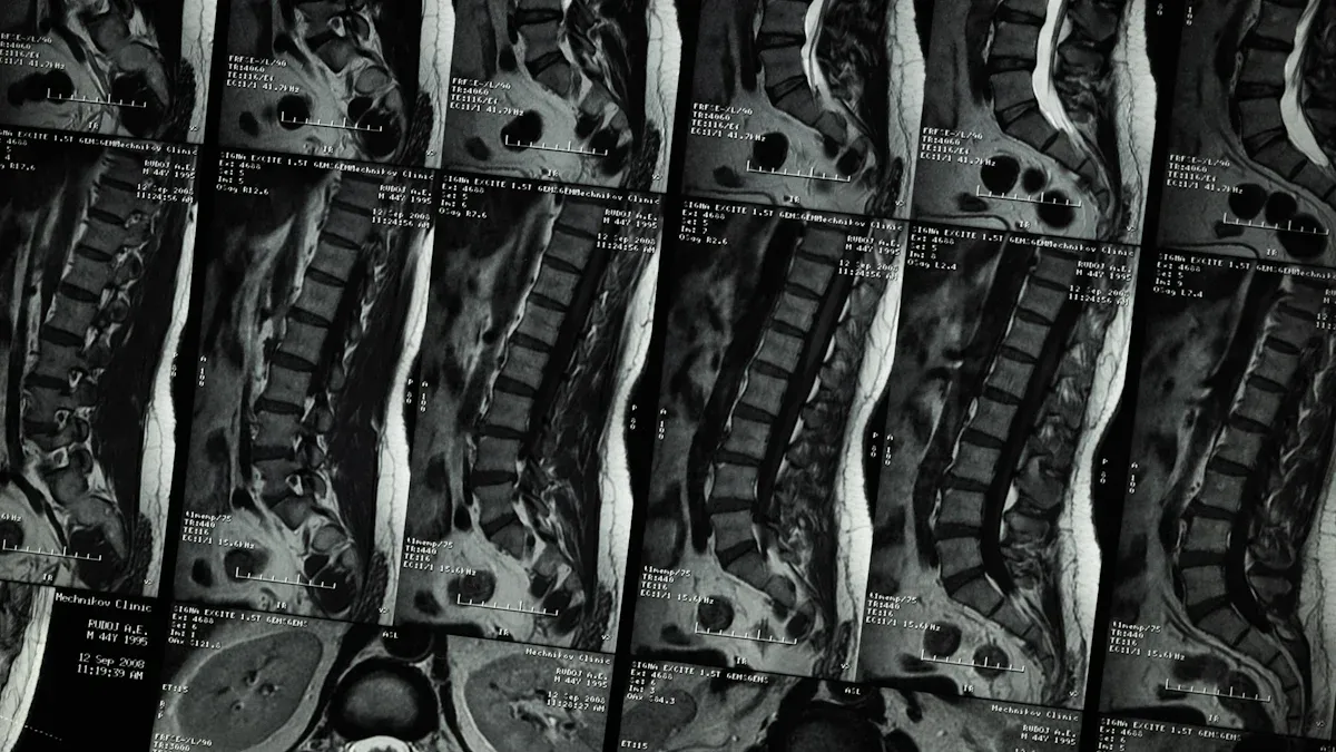 Conditions Affecting Dermatomes and Pain
