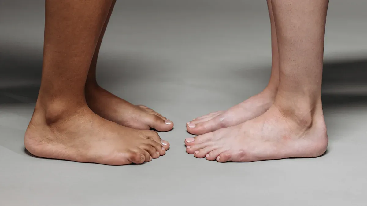 Causes: Why One Leg Is Bigger Than The Other