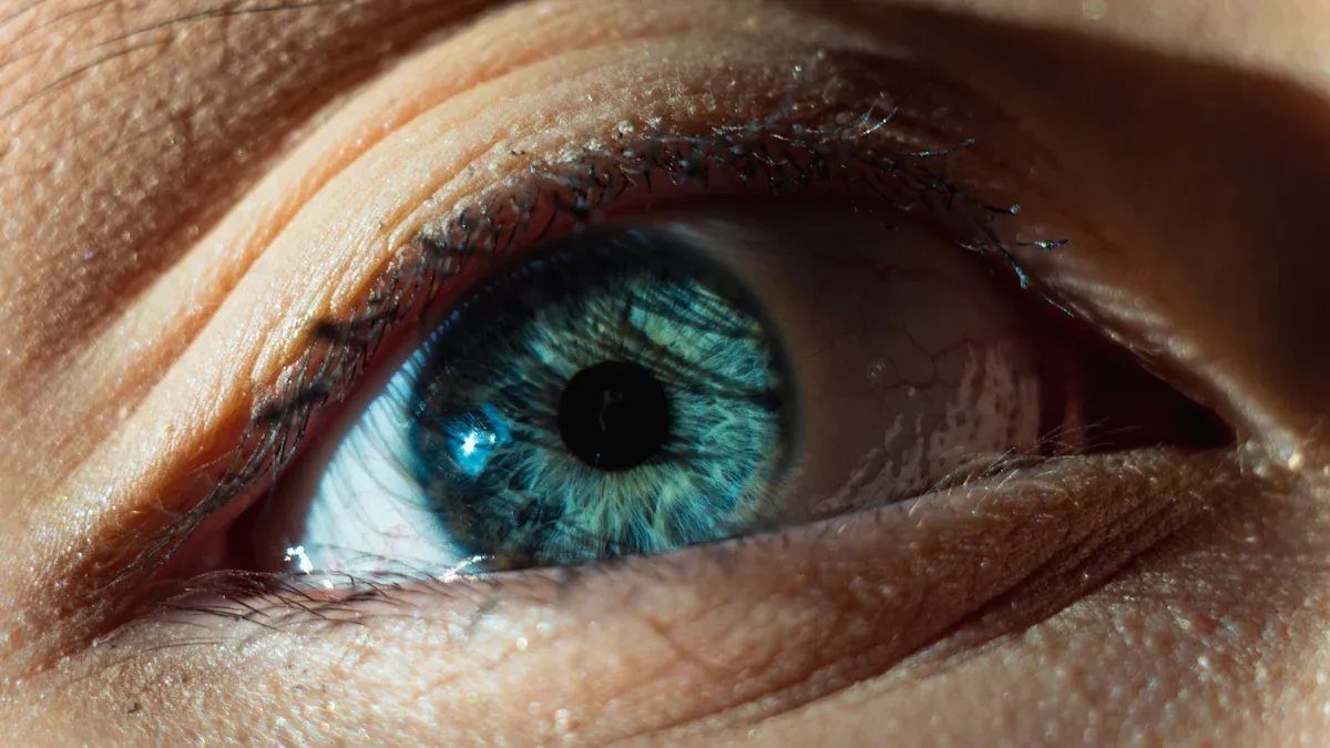 Direct Eye Problems from Hypothyroidism