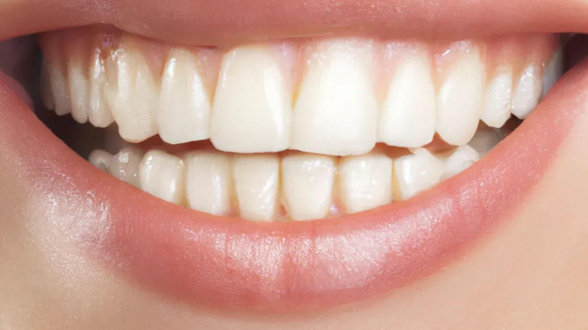 Pros of Zoom Whitening