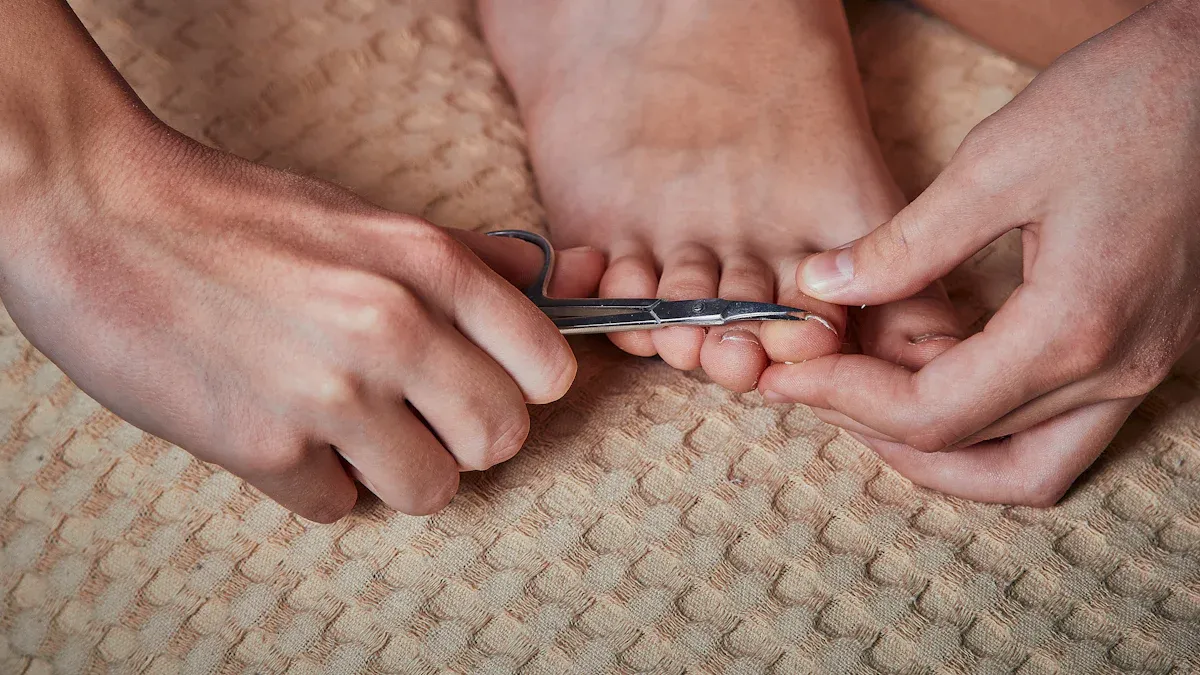 Immediate Steps When You Cut Your Toenail Too Short