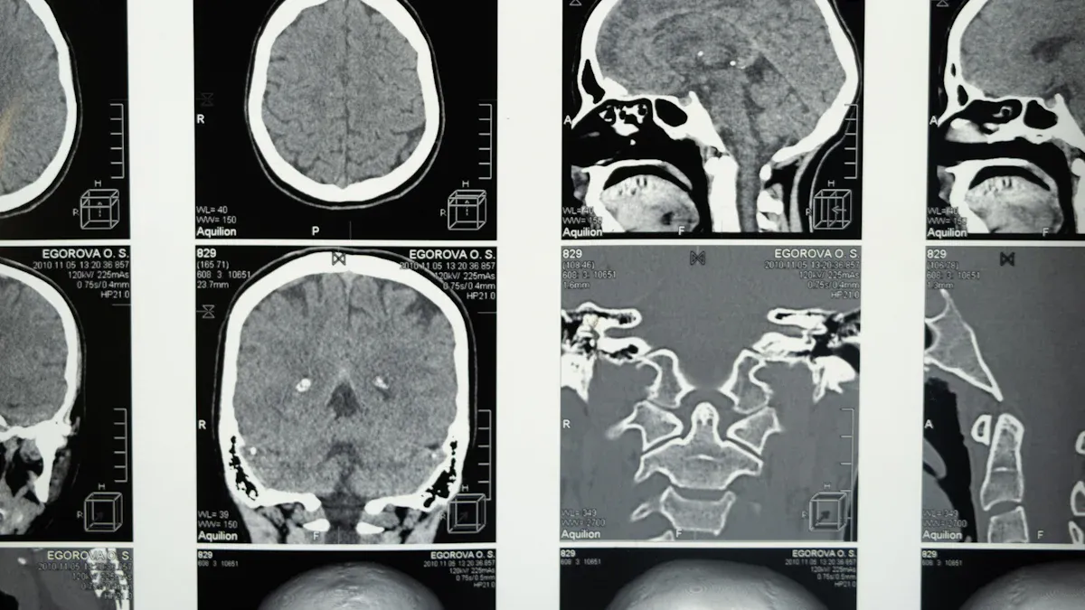 Diagnosing Brain Crackling