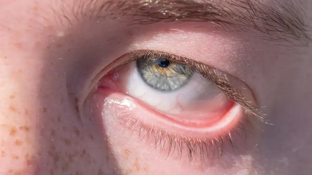 Understanding Allergy Symptoms and Triggers