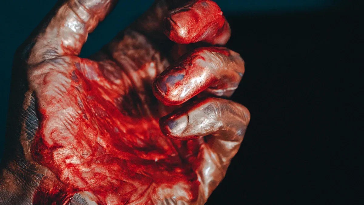 Symptoms of a Swollen Hand Injury