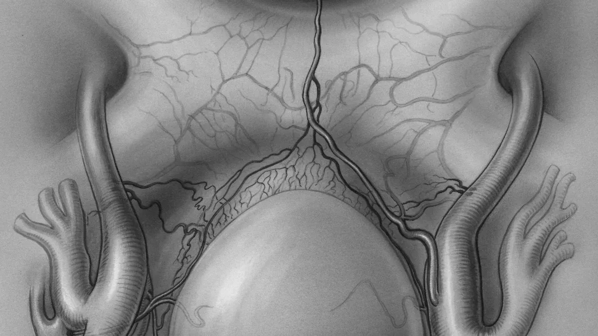 Gynecological Causes of Abdominal Pain