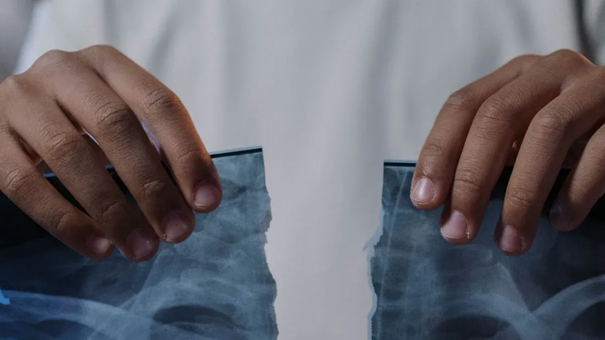 Angiogram Side Effects: Urgent Risks You Must Know