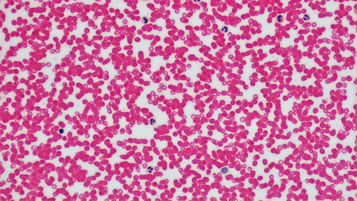 What Are Immature Granulocytes?