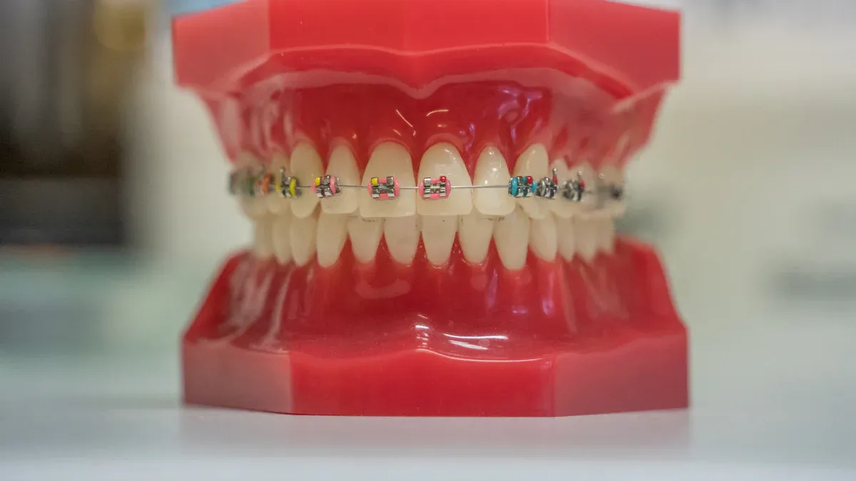 Why Orthodontic Rubber Bands Are Essential for Braces