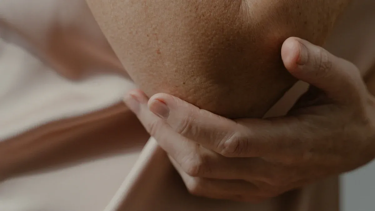 Lipoma Symptoms: Identifying a Lump Under Skin