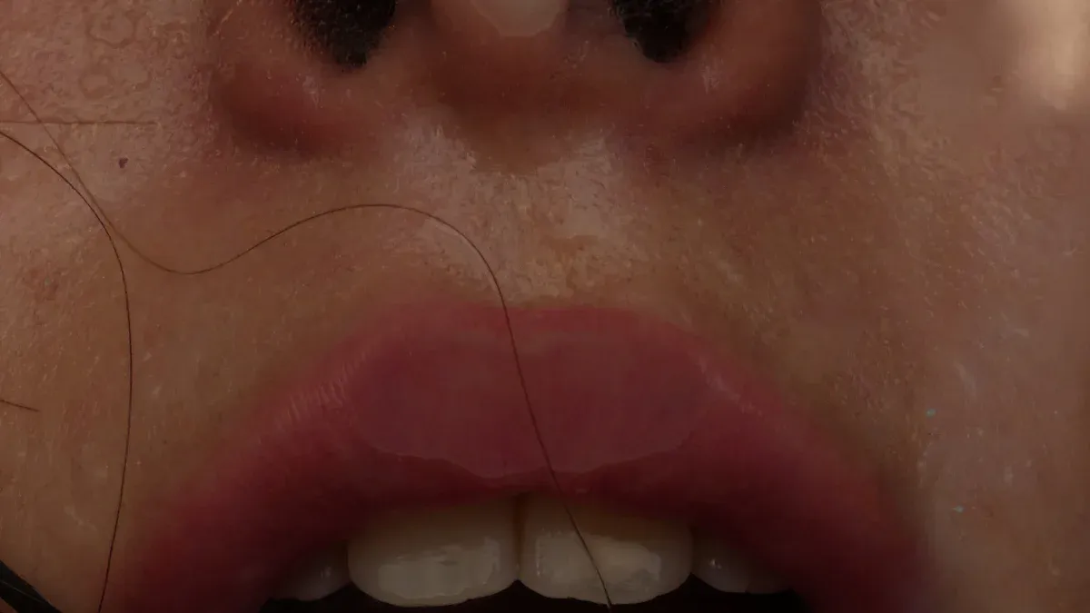 Urgent Causes of Sudden Upper Lip Swelling