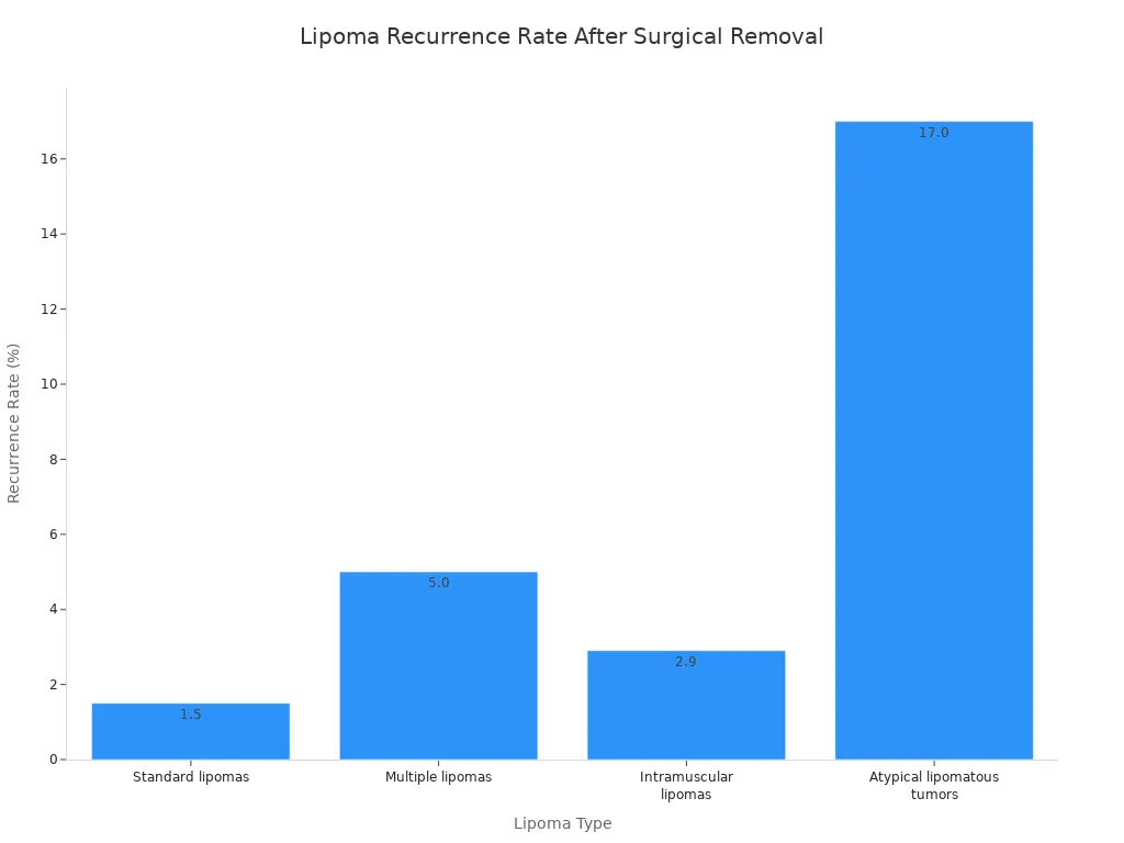 A bar chart showing the recurrence rates of different lipoma types after surgical removal. Standard lipomas have a 1-2% recurrence, multiple lipomas up to 5%, intramuscular lipomas 2.9% at 5 years, and atypical lipomatous tumors 17%.