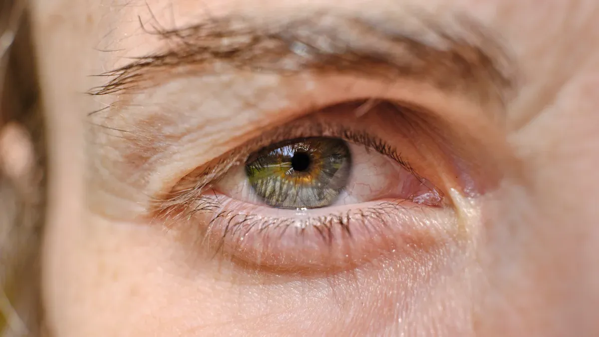 Diagnosing and Managing Ocular Manifestations of Thyroid Disorders