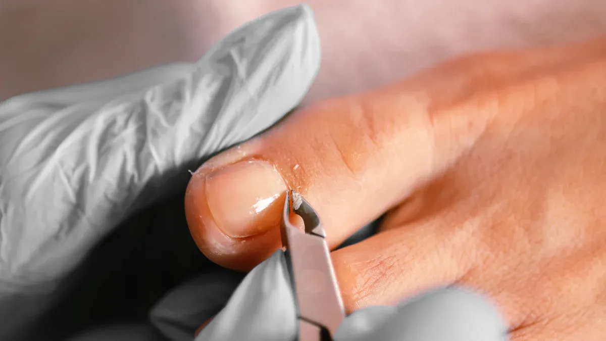 Treatment for White Toenails