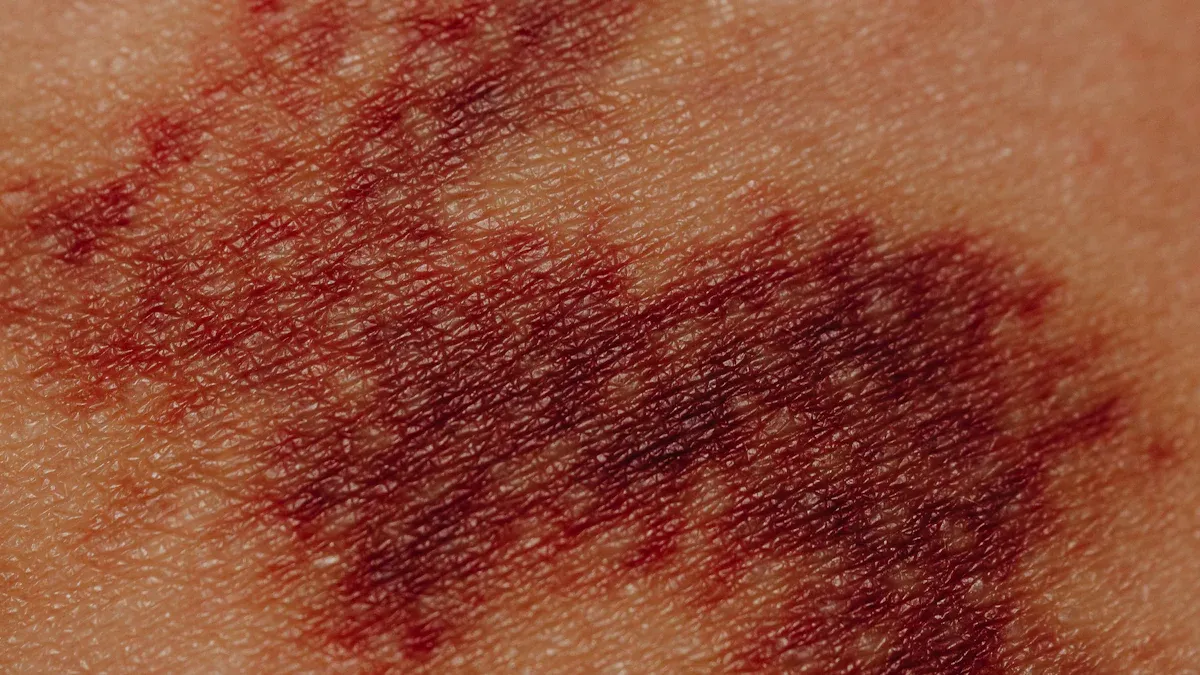 Common Causes of Rash Behind Knee